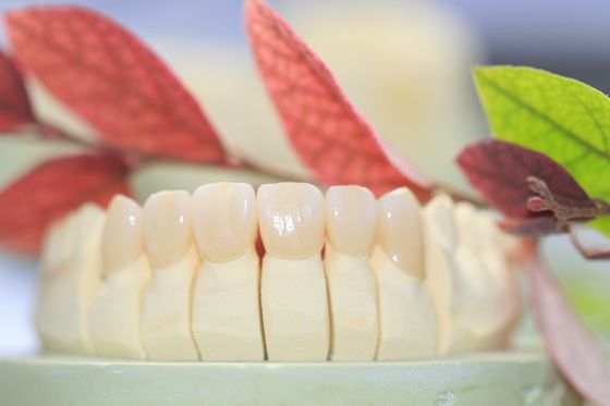 O laboratório dental fixou próteses mergulhou a coroa dental da zircônia para Front Teeth