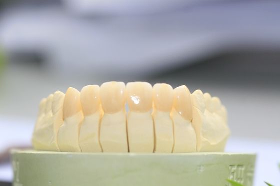 Coroa dental da grande zircônia completa do contorno de Biocompatibility para o laboratório dental