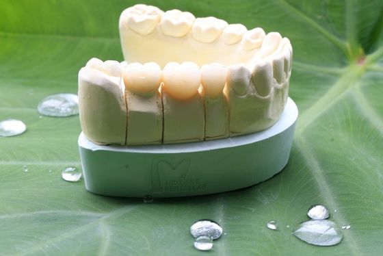 Coroa dental da grande zircônia completa do contorno de Biocompatibility para o laboratório dental