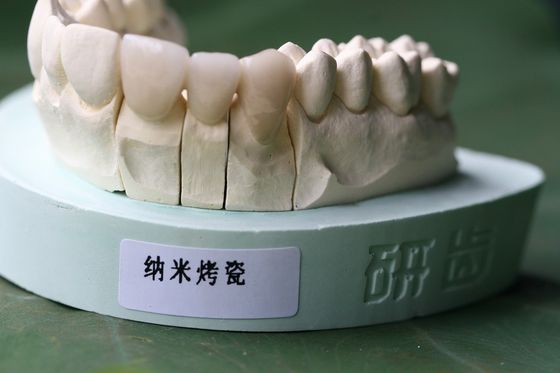 Boa Biocompatibility PFM coroa dental não preciosa de ISO13485