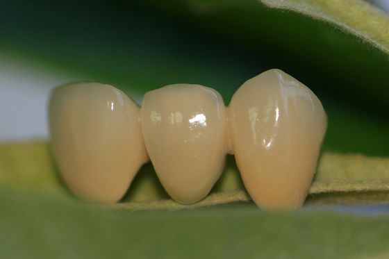 Coroa dental da zircônia ISO13485 cerâmica completa dental do laboratório do projeto para os dentes anteriores