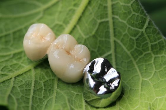 Coroa dental da estrutura PFM do metal
