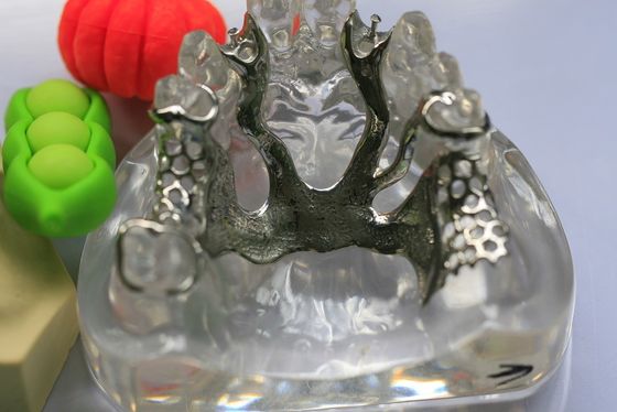 Estrutura parcial do metal da dentadura do Co do Cr