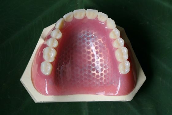 3D que imprime a estrutura parcial do metal da dentadura do esqueleto do metal