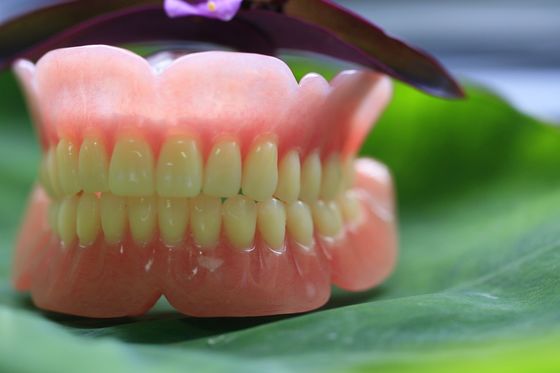 Dentadura parcial acrílica do arco completo
