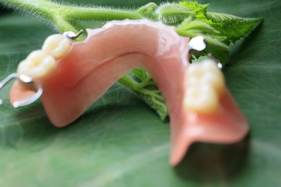 Dentadura parcial acrílica removível parcial