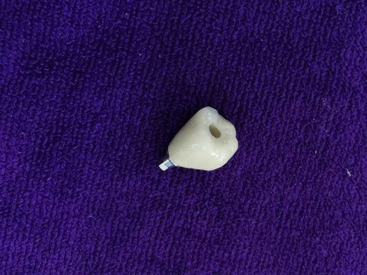 Grande coroa apoiada do implante dental de Biocompatibility ANKYLOS