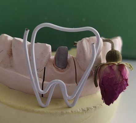 Cargo e núcleo dentais do metal após o tratamento Endodontic