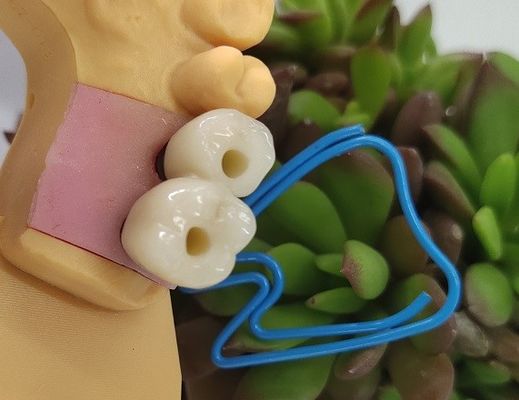 Os implantes dentais de Endosseous coroam