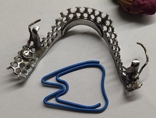 Estrutura parcial do metal da dentadura do arco mandibular de Casted