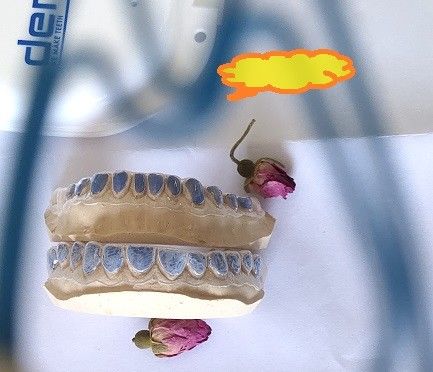 ISO13485 descoramento feito sob encomenda Tray For Whitening Teeth