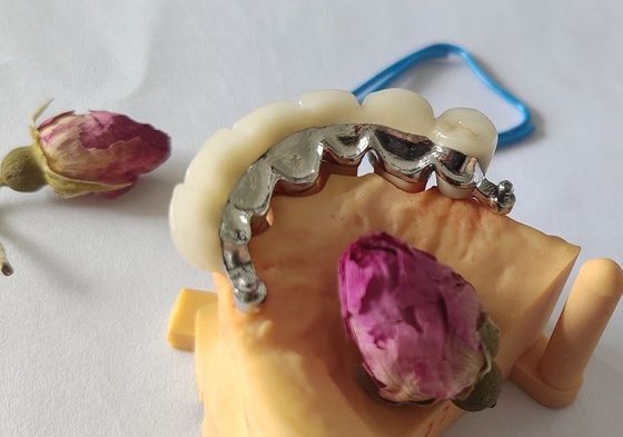 Coroa dental da estrutura PFM do metal