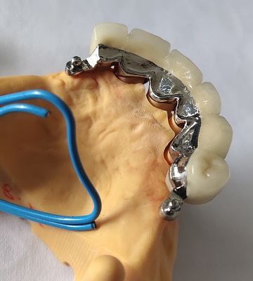 Coroa dental cerâmica da aptidão PFM do metal boa
