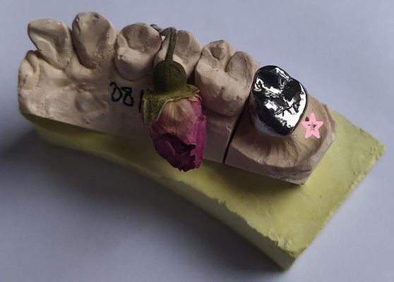 O metal baixo do molde completo liga a coroa dental
