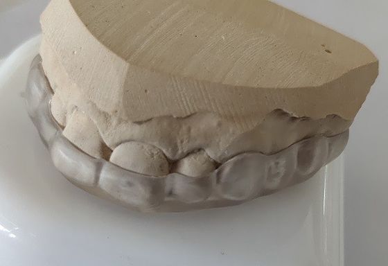 O Esthetics abaixa a parte de boca do arco para o aperto de dentes