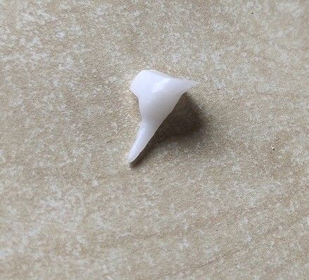 Reforçando a porcelana Pin Core dental de EMAX