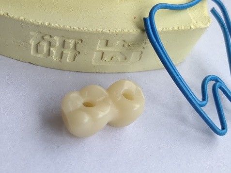 Cópia 3D dental do projeto do CAD CAM