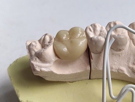 Dentes do zirconita da porcelana