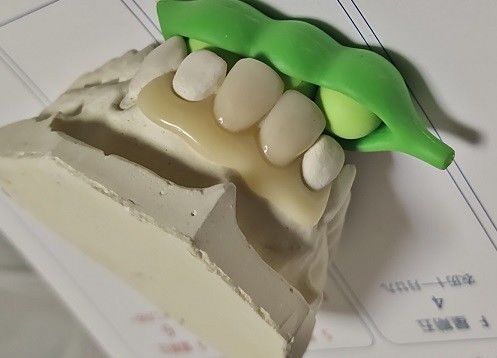 Dentadura invisível livre do metal da resina para o paciente alérgico