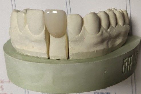 A zircônia obstrui a cópia 3D dental pela trituração do CAD CAM