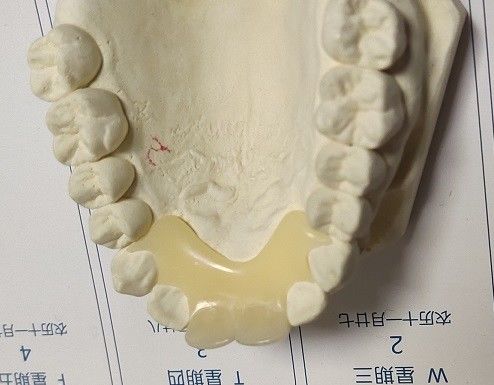 Dentadura invisível de nylon elástica macia de Trushine