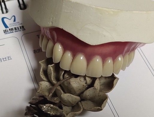 Dentadura parcial acrílica do Esthetics permanente completo da dentadura