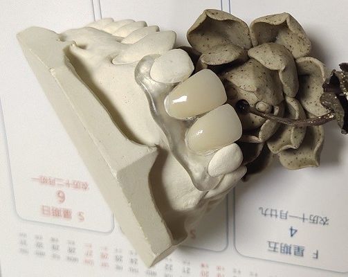 Dentadura invisível de nylon elástica macia de Trushine