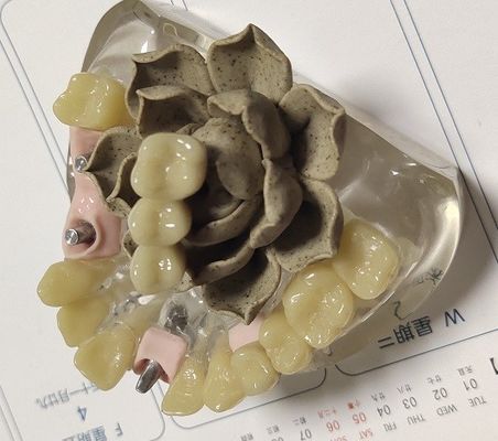 100 coroa provisória de Biocompatibility PMMA dos por cento