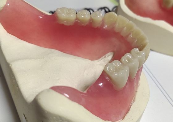 Dentadura parcial acrílica curada fria da dentadura completa do Esthetics
