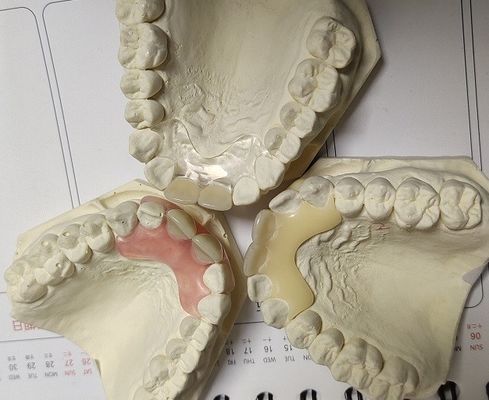 Dentadura invisível macia e elástica provisória de Valplast