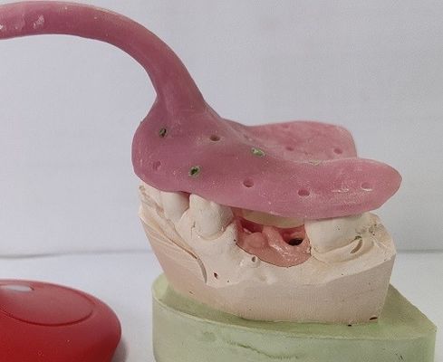 Bandejas feitas sob encomenda da impressão da dentadura