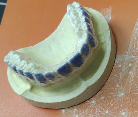 Dentes ISO13485 que claream o protetor For Smoke Stains do descorante