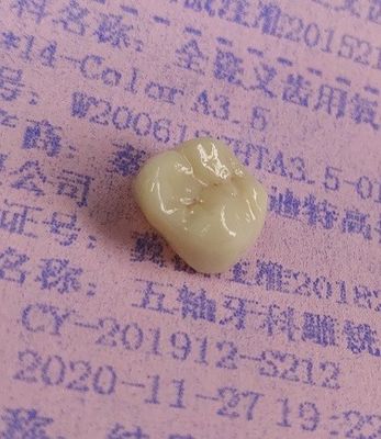 A zircônia obstrui a cópia 3D dental pela trituração do CAD CAM