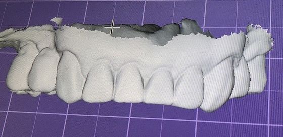 zombaria de 3D Digitas acima dos dentes outros produtos dentais