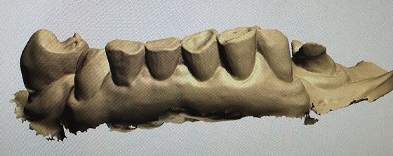 zombaria de 3D Digitas acima dos dentes outros produtos dentais