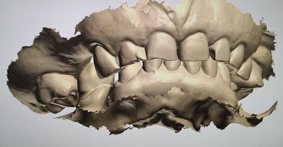 Dentes do modelo da indicação digital do projeto do CAD CAM outros produtos dentais