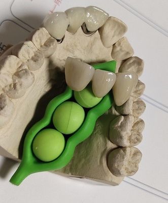 Cópia 3D dental do projeto do CAD CAM