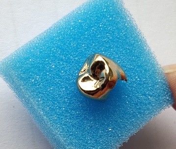 Coroa dental do metal completo nobre alto do ouro