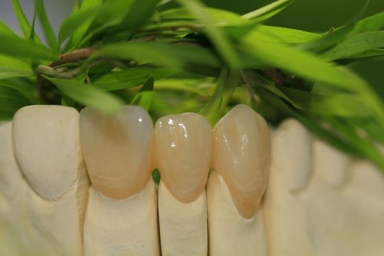 As estrelas completas da coroa 5 do óxido de zircônio da odontologia protética projetam o laboratório dental