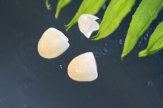 Coroa dental natural de EMAX