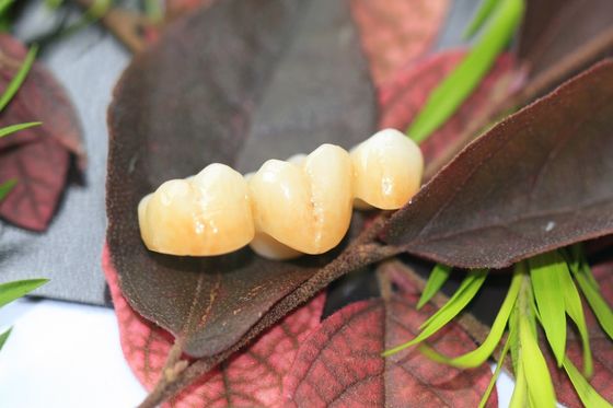 Da zircônia monolítica dental do laboratório do projeto coroa dental para os dentes traseiros dos molares