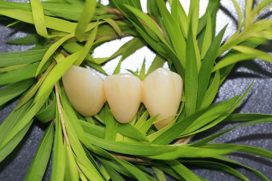 Coroa dental natural de EMAX