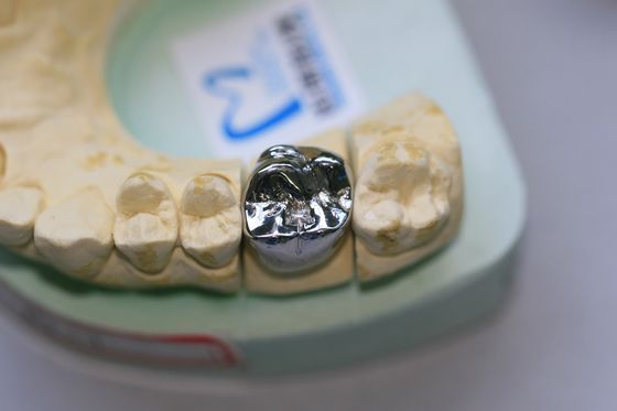 O metal baixo do molde completo liga a coroa dental