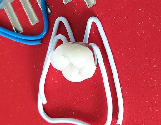 Da ponte dental da impressão da coroa 3D do laboratório PFM coroa dental