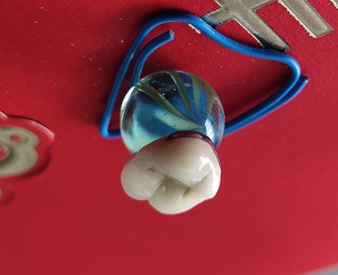 Porcelana dental da coroa do CAD CAM PFM do produto do laboratório fundida ao metal