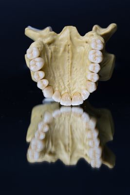 Esthetics dental das estrelas da coroa 5 da zircônia dental da porcelana do laboratório
