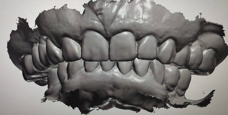 Dentes do modelo da indicação digital do projeto do CAD CAM outros produtos dentais