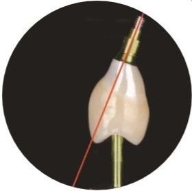 O ASC natural dobrou o canal que do parafuso os implantes dentais coroam
