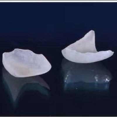 Natural olhar toda a porcelana folheia a coroa dental de EMAX
