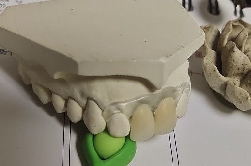Dentadura invisível macia e elástica provisória de Valplast